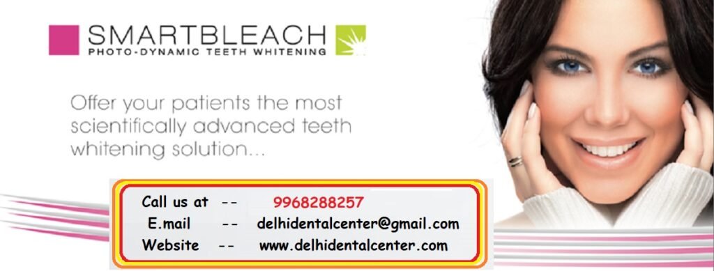 Teeth Whitening Delhi