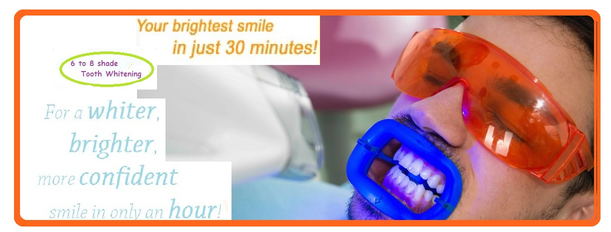 Teeth Whitening Dentist Delhi