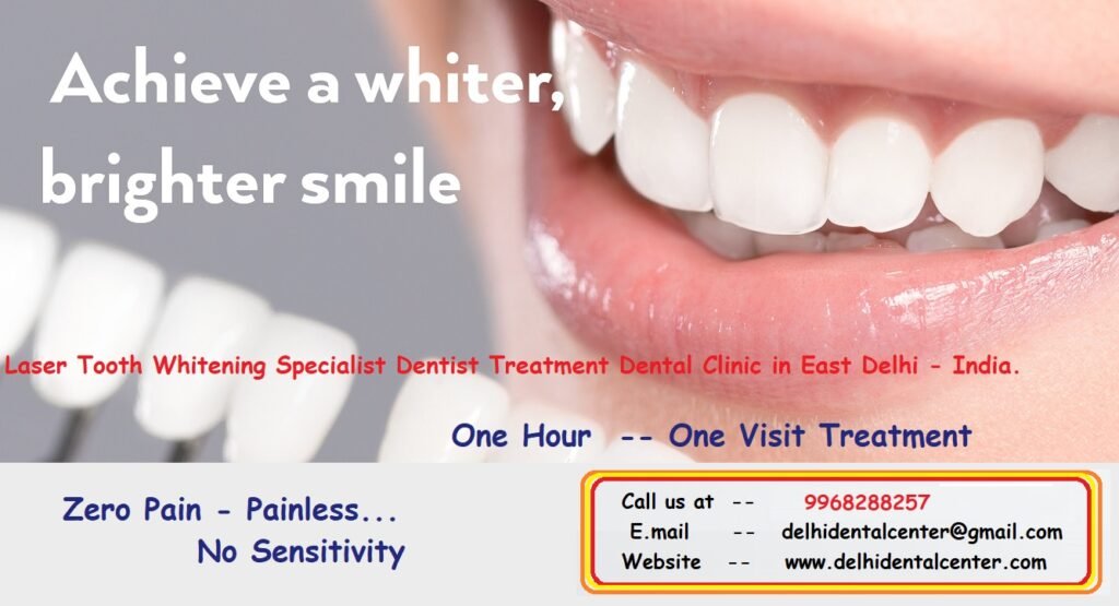 Laser Tooth Whitening Dental Clinic in Delhi