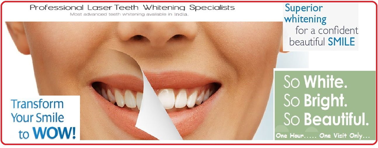 Teeth whitening procedure delhi