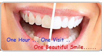 Tooth Whitening Clinic in East Delhi