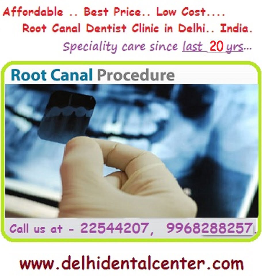 Root Canal Treatment Delhi