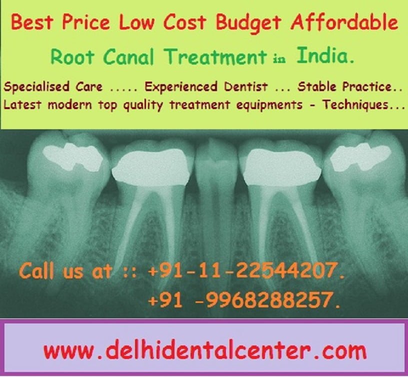 root-canal-treatment-dental-clinic-in-East-Delhi-India.