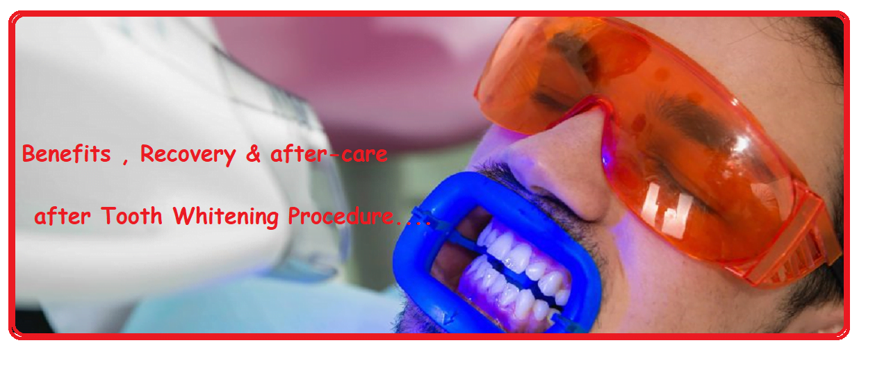 Tooth Whitening Clinic Delhi