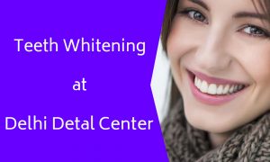 Tooth Whitening Delhi