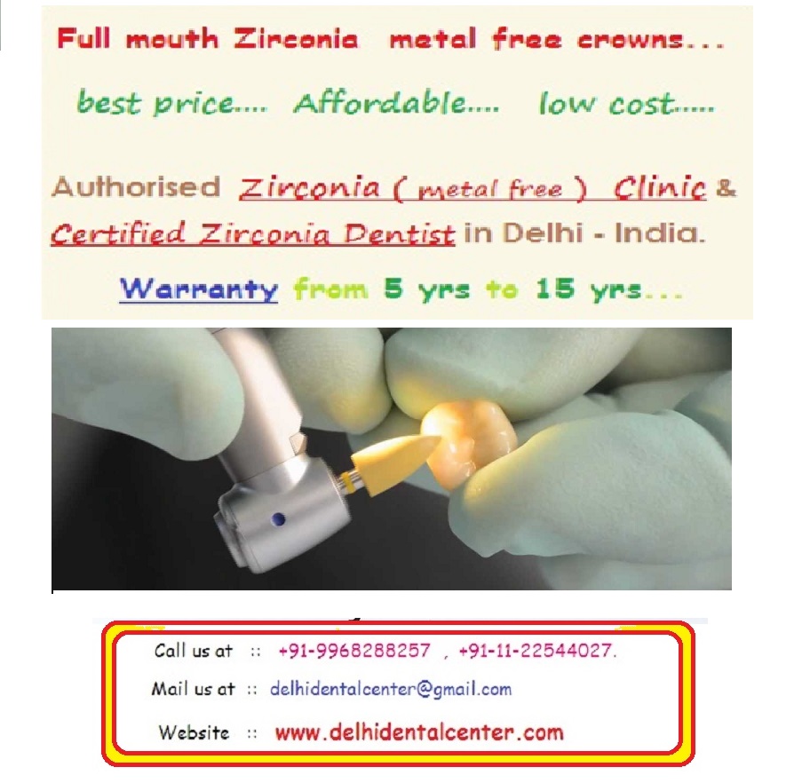 Zirconia Dental Crown Treatment Delhi.