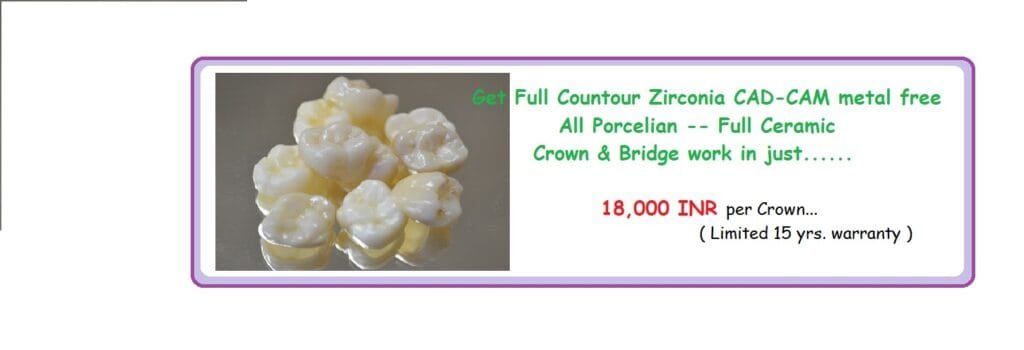 Zirconia Dental Crown in Delhi.